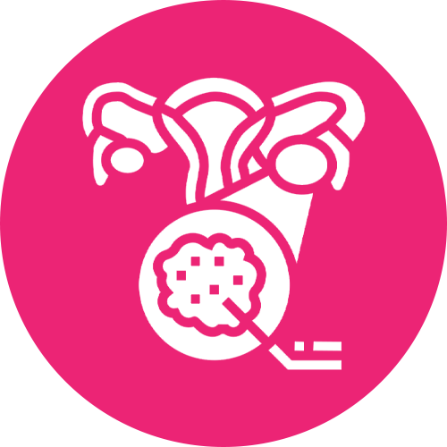 Polycystic Ovaries